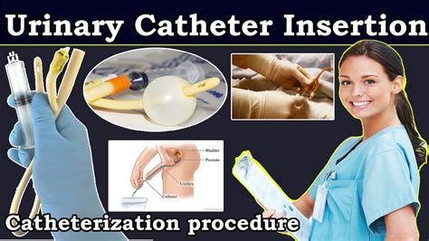 porn catheter|Catheter Insertion Porn Videos 